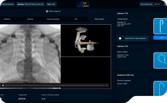 AngioVision simulator software interface