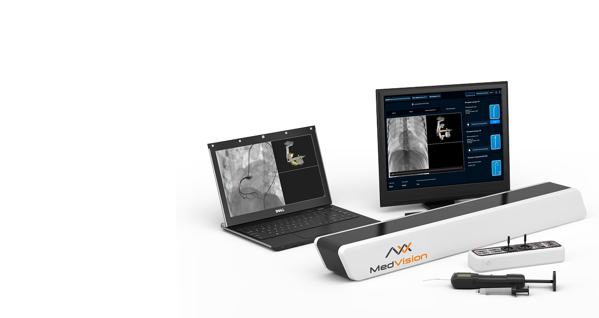 AngioVision Smart Endovascular Intervention Simulator