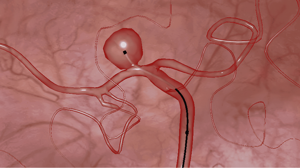 Basic Course: Embolization Coiling Skills Training