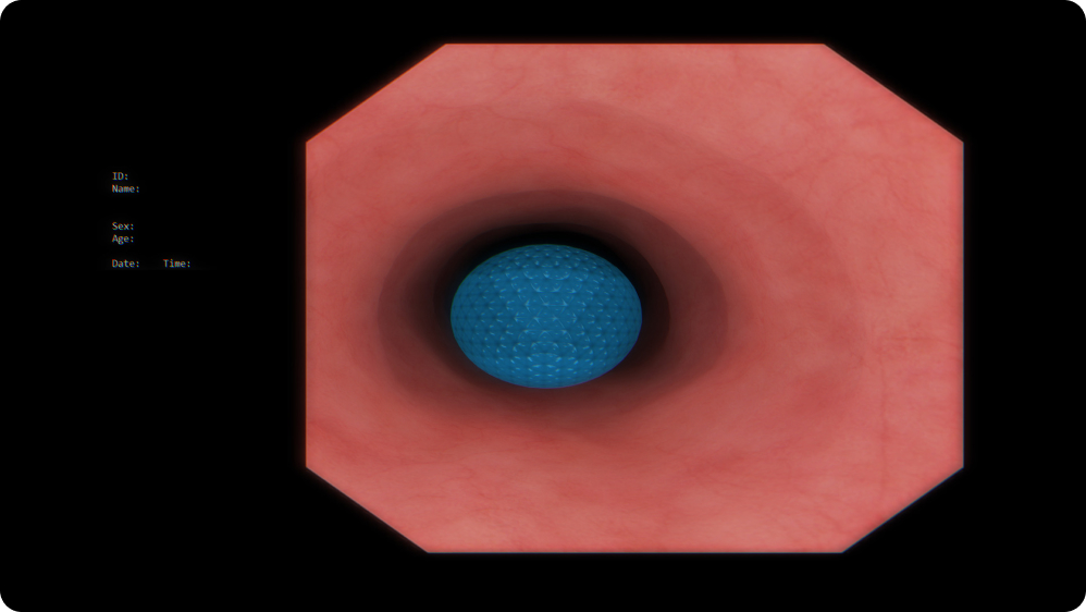 Bronchoscopy: Bronchoscope handling in real-world anatomy