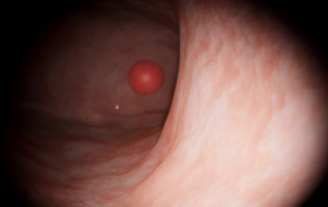 Gynecology: Basic Skills — 0° Hysteroscope handling skills
