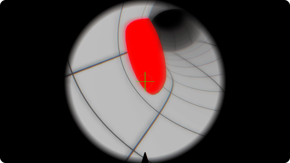 Urology: Basic Resectoscope Handling Skills for Oblique-Viewing Optics