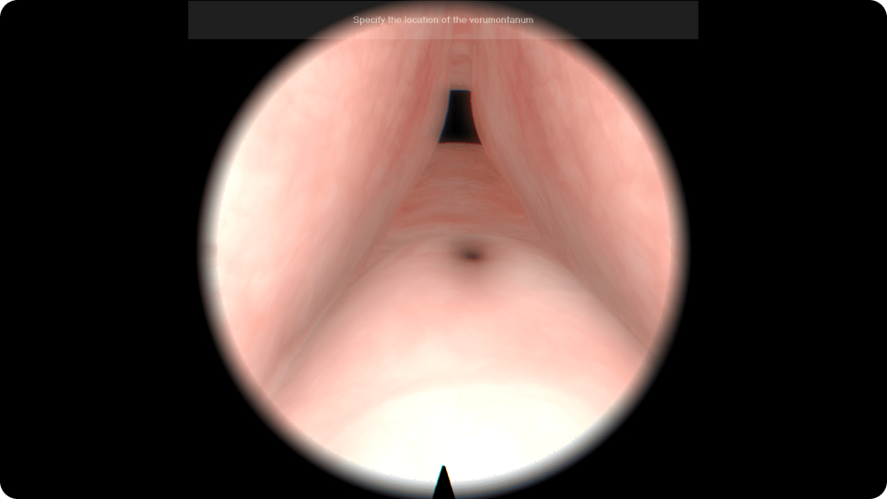 Urology: Anatomical Landmark Visualization