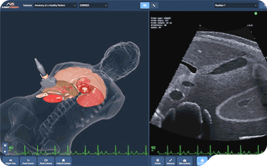 main-blog-Use of Realistic Ultrasound Probes and High-Fidelity 3D Visualization