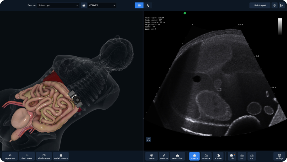 Abdominal Ultrasound